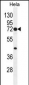 PTGS2 Antibody (Center P378)